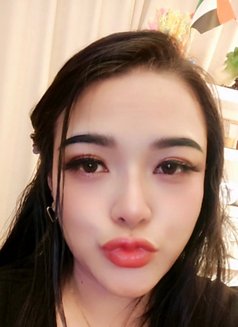 Photo 24